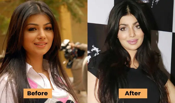 Ayesha Takia big boobs surgery after before pic - Ayesha Takia sexy pic video